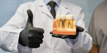 Megagen AnyOne — сучасне рішення для заміни втрачених зубів