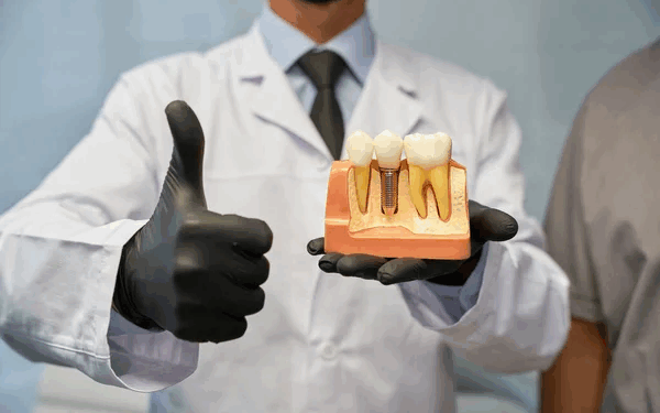 Megagen AnyOne — сучасне рішення для заміни втрачених зубів