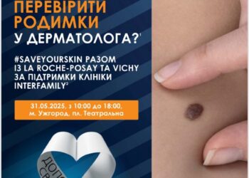 В Ужгороді безкоштовно перевірятимуть родимки — долучитися може кожен (АНОНС) –