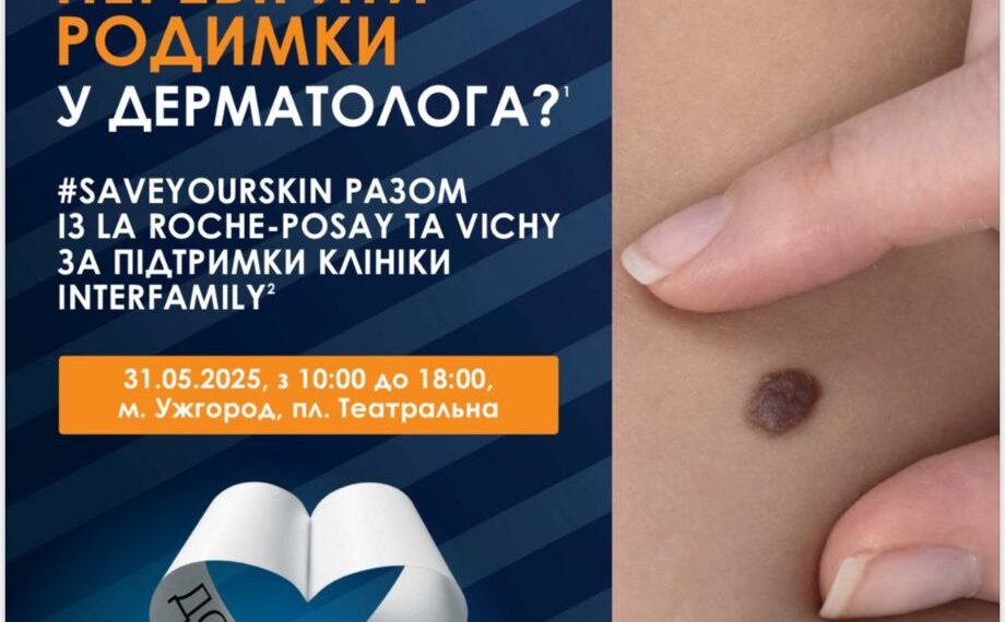 В Ужгороді безкоштовно перевірятимуть родимки — долучитися може кожен (АНОНС) –