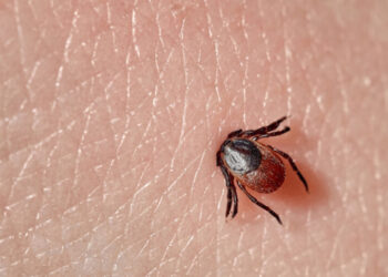 Що робити, якщо ви виявили кліща на тілі: поради від закарпатських фахівців