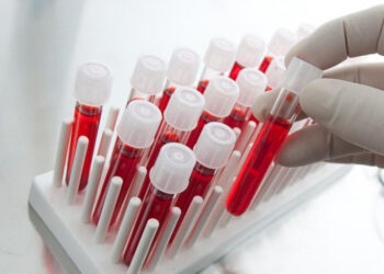 Що таке біохімія крові