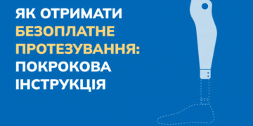 Шлях до протезування: коли починати та як обрати фахівця