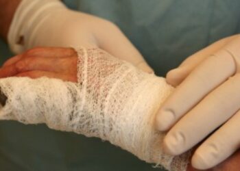 У Мукачеві до реанімації обласної дитячої лікарні з важкими опіками потрапила 5-річна дитина