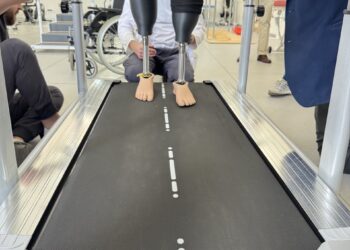 Вперше на Закарпатті: військовому з подвійною ампутацією встановили 3D-протези (ВІДЕО) –