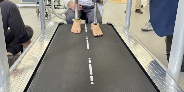 Вперше на Закарпатті: військовому з подвійною ампутацією встановили 3D-протези (ВІДЕО) –