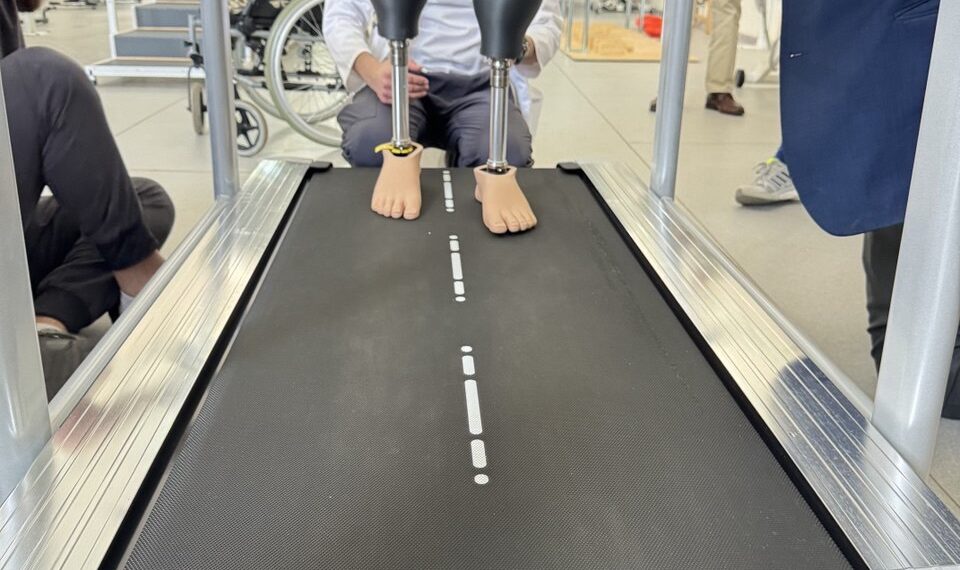 Вперше на Закарпатті: військовому з подвійною ампутацією встановили 3D-протези (ВІДЕО) –