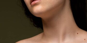 Так у народі вірять: які родимки приносять щастя й удачу — на шиї, носі чи щоках — Закарпаття