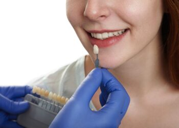 Чи можна встановити вініри на криві зуби?