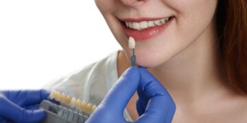 Чи можна встановити вініри на криві зуби?