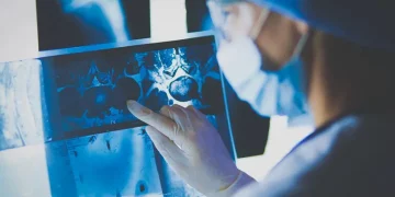 Лечение рака – как биомедицина учит тело распознавать злокачественные клетки – Здоров’я