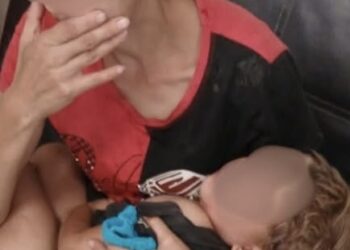 На Берегівщині трирічний хлопчик заклеїв очі суперклеєм (ФОТО)