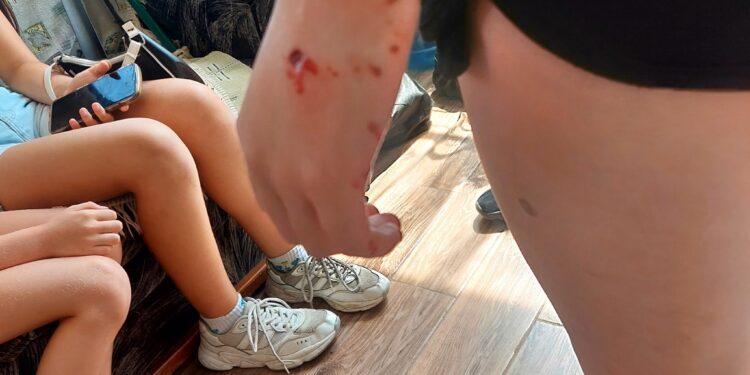 В Ужгороді поліція розпочала розслідування через напад собак на людей (ФОТО)