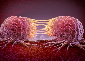 Рак у мужчин – эксперт призвала не игнорировать симптомы – Здоров’я