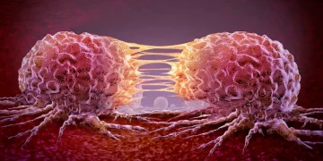 Рак у мужчин – эксперт призвала не игнорировать симптомы – Здоров’я