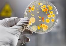 Симптоми схожі на грип: як розпізнати лептоспіроз і чому на Закарпатті терміново проводять суцільну дератизацію –