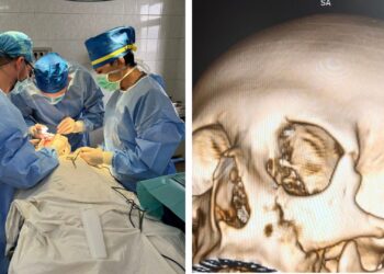 Закарпатські лікарі відновили обличчя 14-річного хлопця після серйозного перелому (ФОТО)