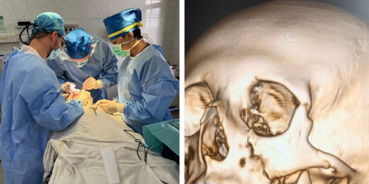 Закарпатські лікарі відновили обличчя 14-річного хлопця після серйозного перелому (ФОТО)